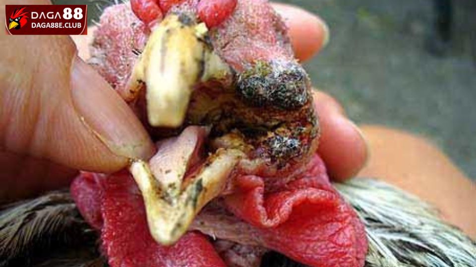 Các cách điều trị bệnh đậu gà